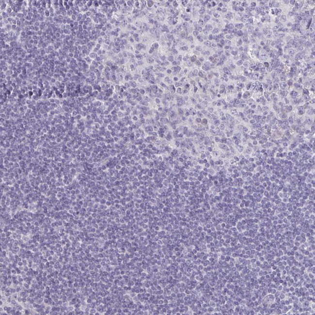 A1CF Antibody in Immunohistochemistry (IHC)