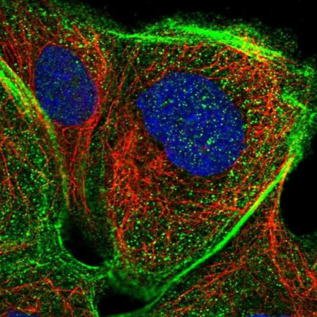 PSTK Antibody in Immunocytochemistry (ICC/IF)