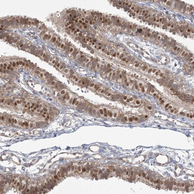 KBTBD4 Antibody in Immunohistochemistry (IHC)