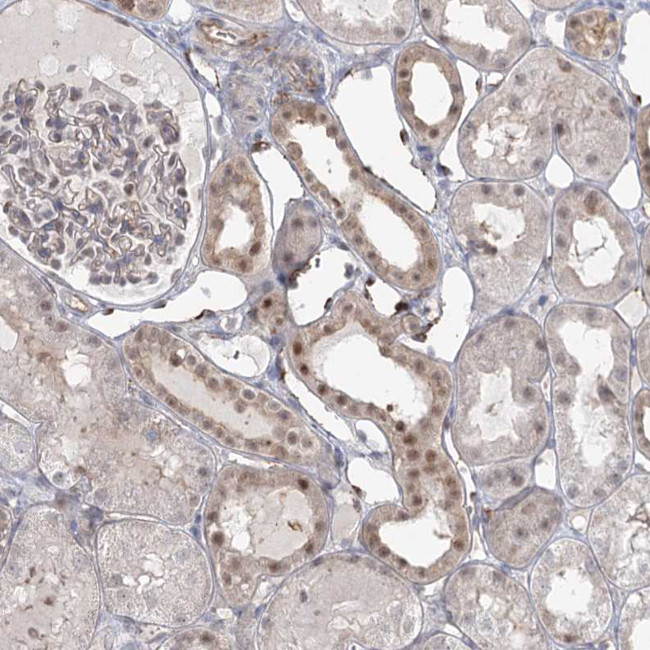 KBTBD4 Antibody in Immunohistochemistry (IHC)