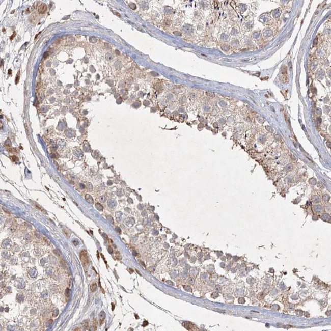 KBTBD4 Antibody in Immunohistochemistry (IHC)