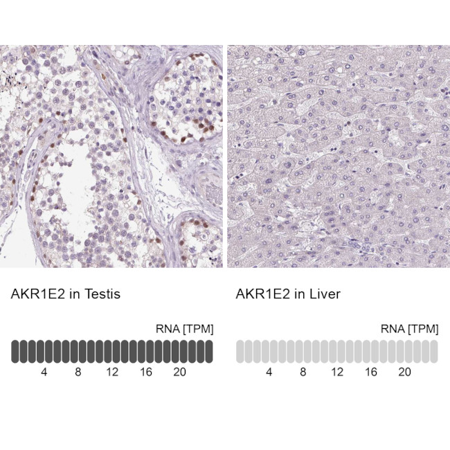 AKR1E2 Antibody in Immunohistochemistry (IHC)