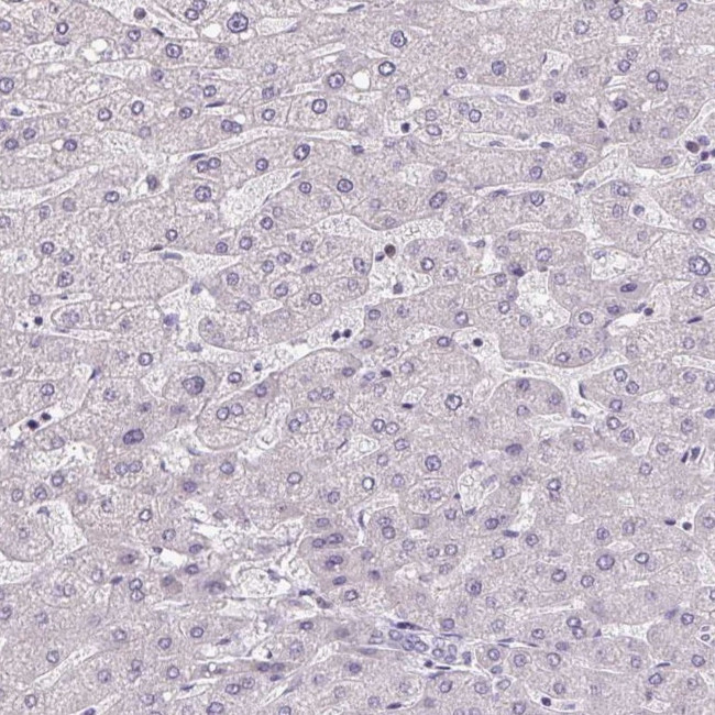 AKR1E2 Antibody in Immunohistochemistry (IHC)