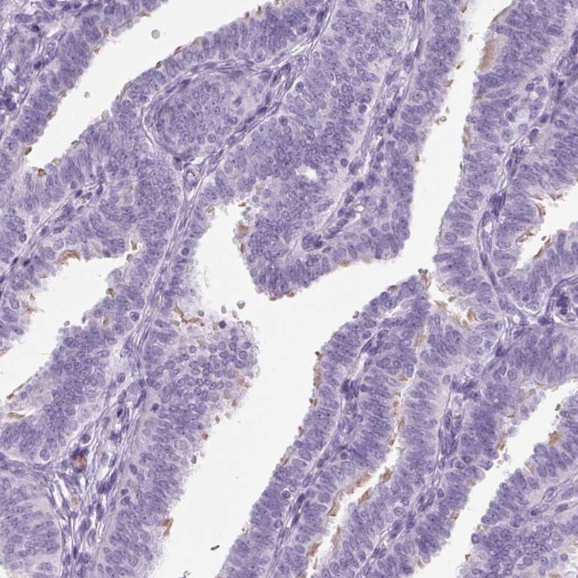 ARMC4 Antibody in Immunohistochemistry (IHC)