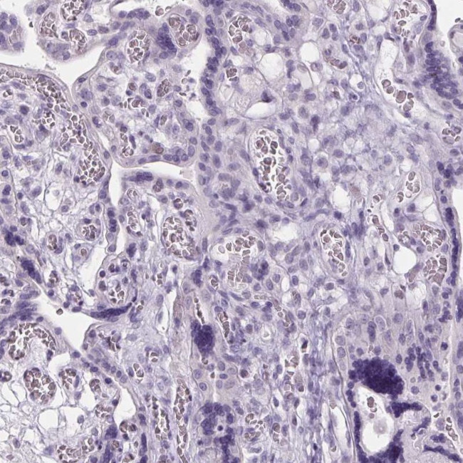 ARMC4 Antibody in Immunohistochemistry (IHC)