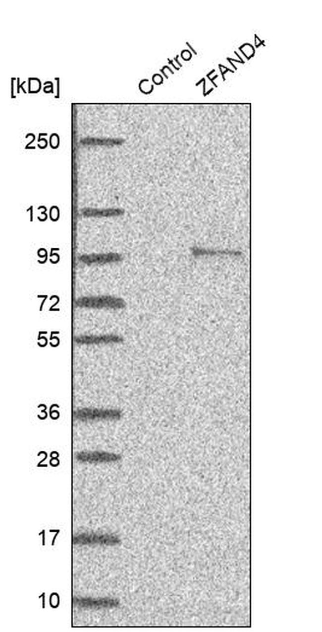 ZFAND4 Antibody in Western Blot (WB)