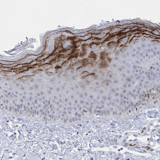 HORMAD1 Antibody in Immunohistochemistry (IHC)