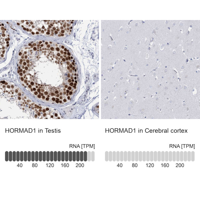 HORMAD1 Antibody