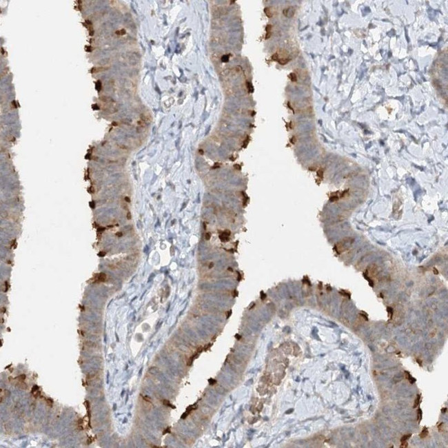 TRAF3IP1 Antibody in Immunohistochemistry (IHC)