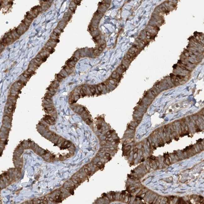 TRAF3IP1 Antibody in Immunohistochemistry (IHC)