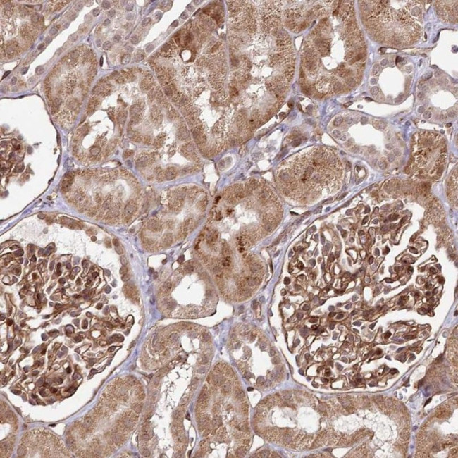 COPG Antibody in Immunohistochemistry (IHC)