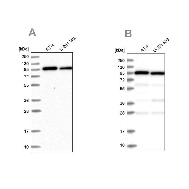 COPG Antibody in Western Blot (WB)