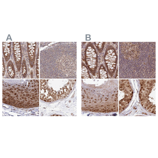 WAPL Antibody in Immunohistochemistry (IHC)