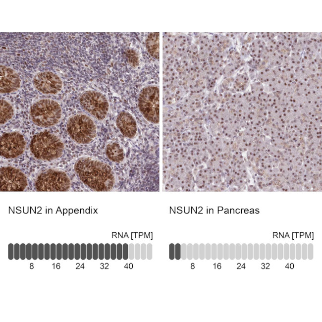 NSUN2 Antibody in Immunohistochemistry (IHC)