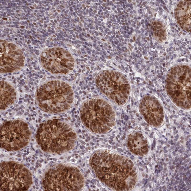 NSUN2 Antibody in Immunohistochemistry (IHC)