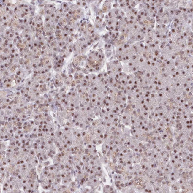 NSUN2 Antibody in Immunohistochemistry (IHC)