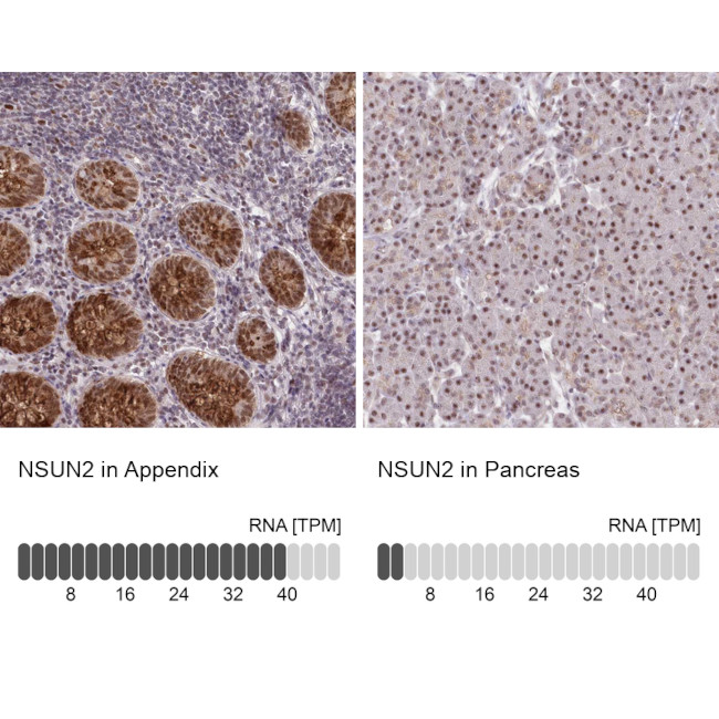 NSUN2 Antibody