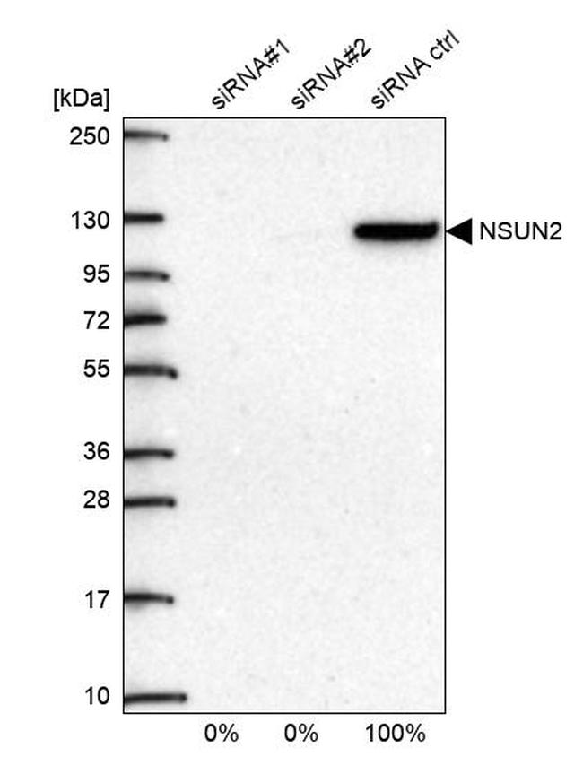 NSUN2 Antibody in Western Blot (WB)