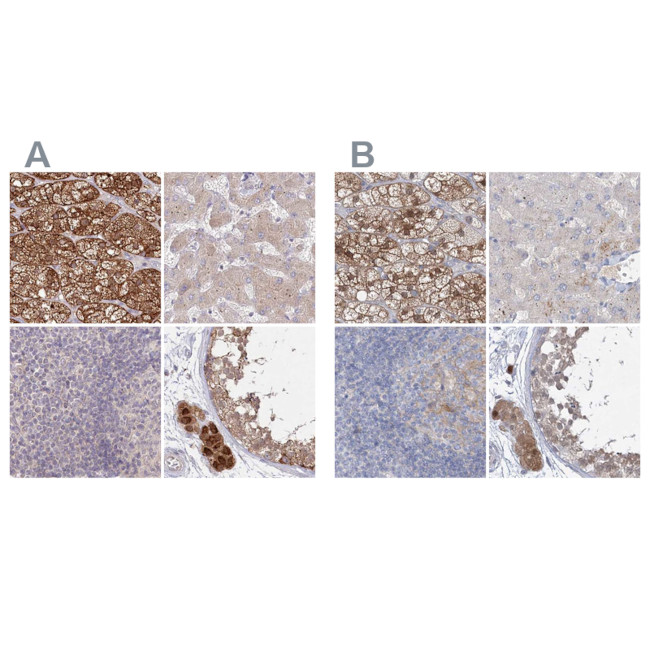 AAMDC Antibody in Immunohistochemistry (IHC)