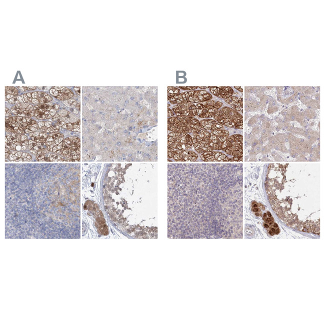 AAMDC Antibody in Immunohistochemistry (IHC)