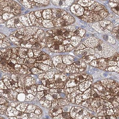 AAMDC Antibody in Immunohistochemistry (IHC)