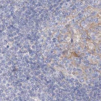 AAMDC Antibody in Immunohistochemistry (IHC)