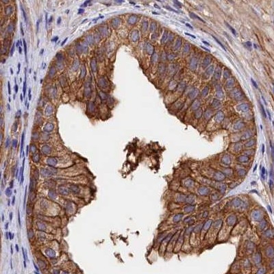 TAB182 Antibody in Immunohistochemistry (IHC)