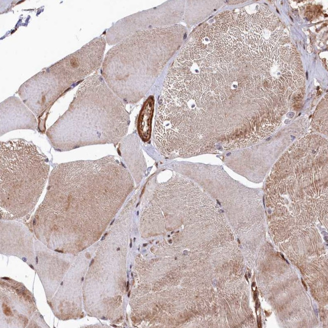 TAB182 Antibody in Immunohistochemistry (IHC)