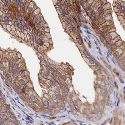 TAB182 Antibody in Immunohistochemistry (IHC)