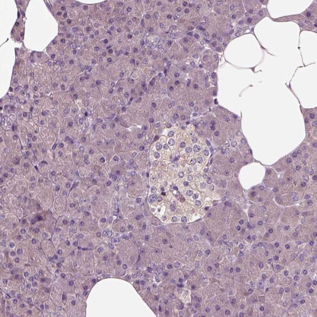 Shootin1 Antibody in Immunohistochemistry (IHC)