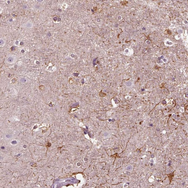 Shootin1 Antibody in Immunohistochemistry (IHC)