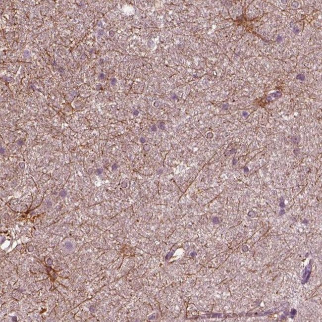 Shootin1 Antibody in Immunohistochemistry (IHC)