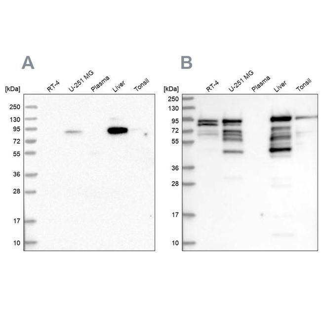 Shootin1 Antibody in Western Blot (WB)