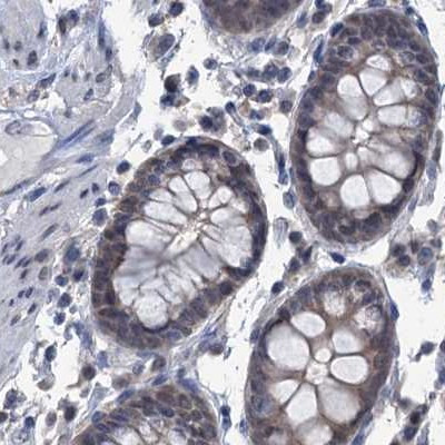 RTKN2 Antibody in Immunohistochemistry (IHC)