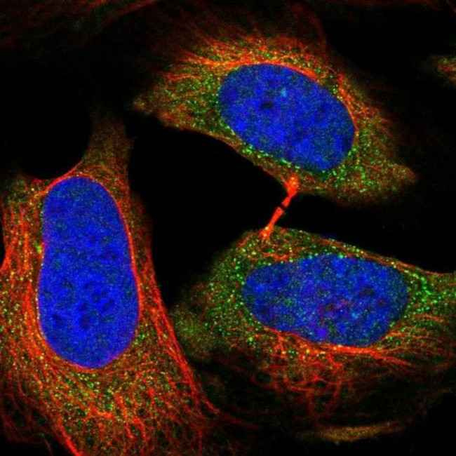 RAPGEF6 Antibody in Immunocytochemistry (ICC/IF)