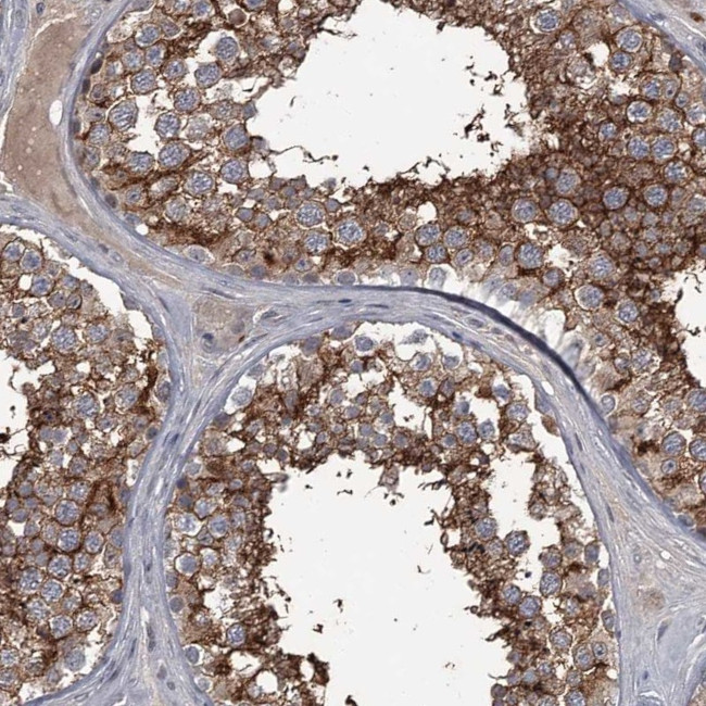 FLVCR2 Antibody in Immunohistochemistry (IHC)