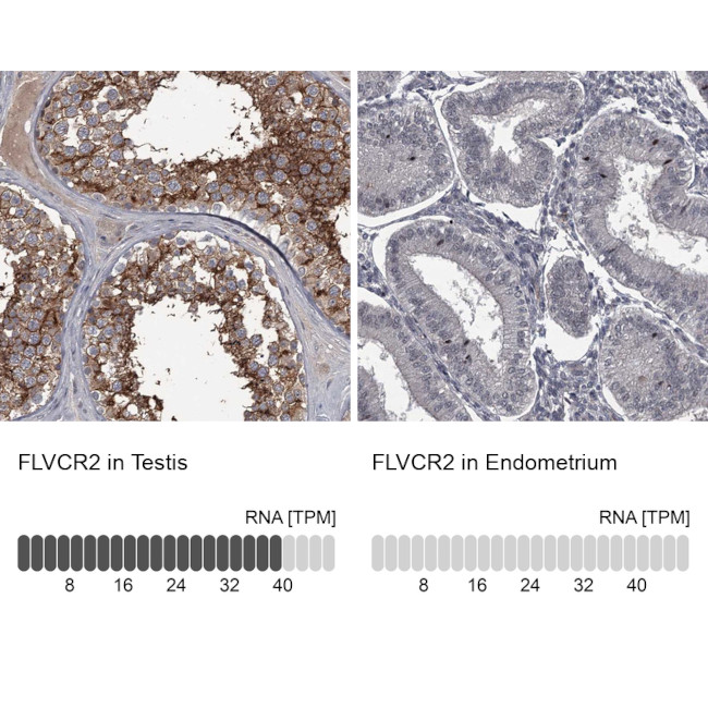 FLVCR2 Antibody