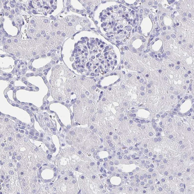 SLC34A2 Antibody in Immunohistochemistry (IHC)