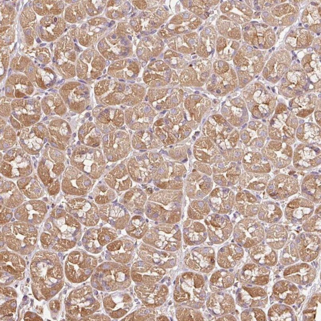 METAP1 Antibody in Immunohistochemistry (IHC)