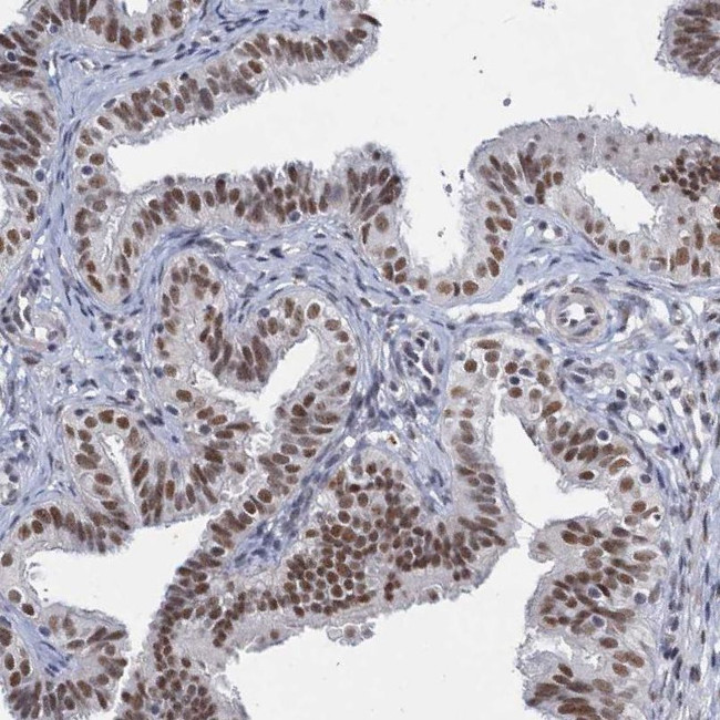 METTL14 Antibody in Immunohistochemistry (IHC)