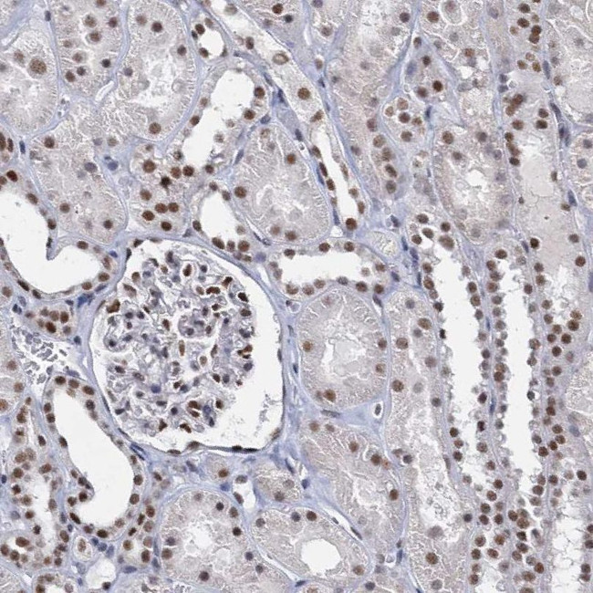 METTL14 Antibody in Immunohistochemistry (IHC)