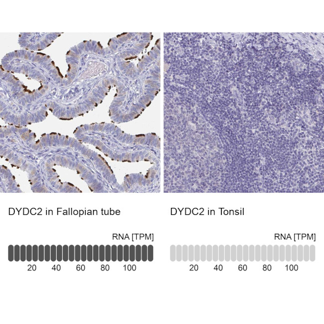 DYDC2 Antibody in Immunohistochemistry (IHC)