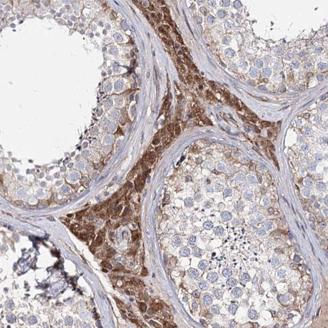 KIAA0825 Antibody in Immunohistochemistry (IHC)