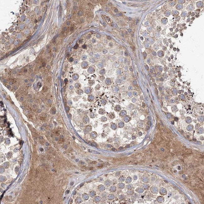 KIAA0825 Antibody in Immunohistochemistry (IHC)