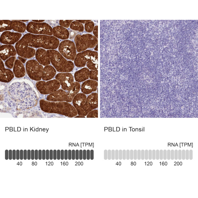 PBLD Antibody in Immunohistochemistry (IHC)