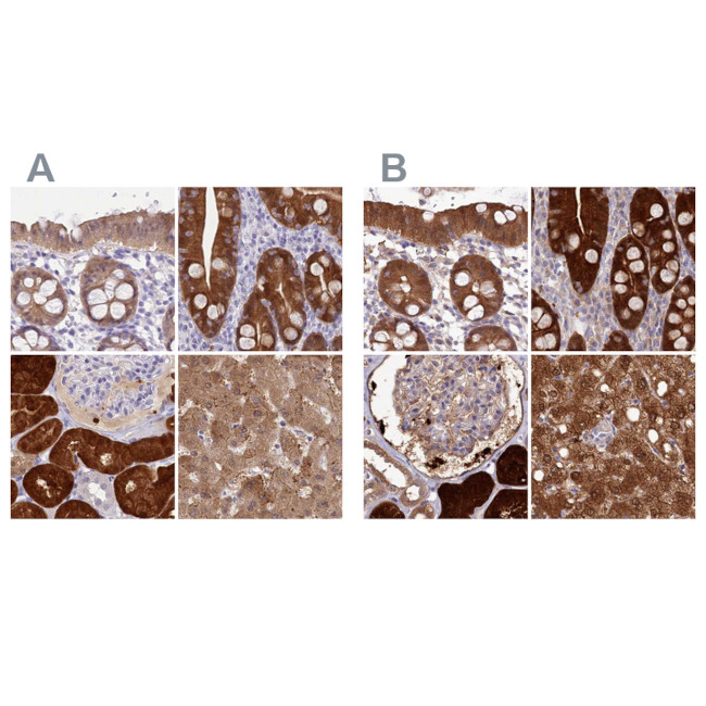 PBLD Antibody in Immunohistochemistry (IHC)