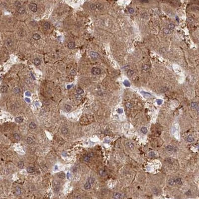 PBLD Antibody in Immunohistochemistry (IHC)