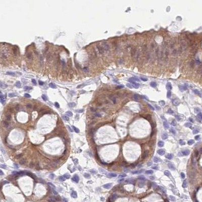 PBLD Antibody in Immunohistochemistry (IHC)