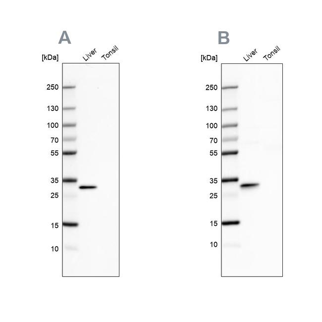 PBLD Antibody in Western Blot (WB)