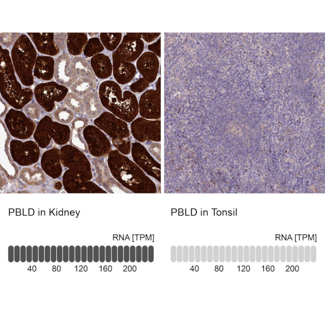 PBLD Antibody in Immunohistochemistry (IHC)